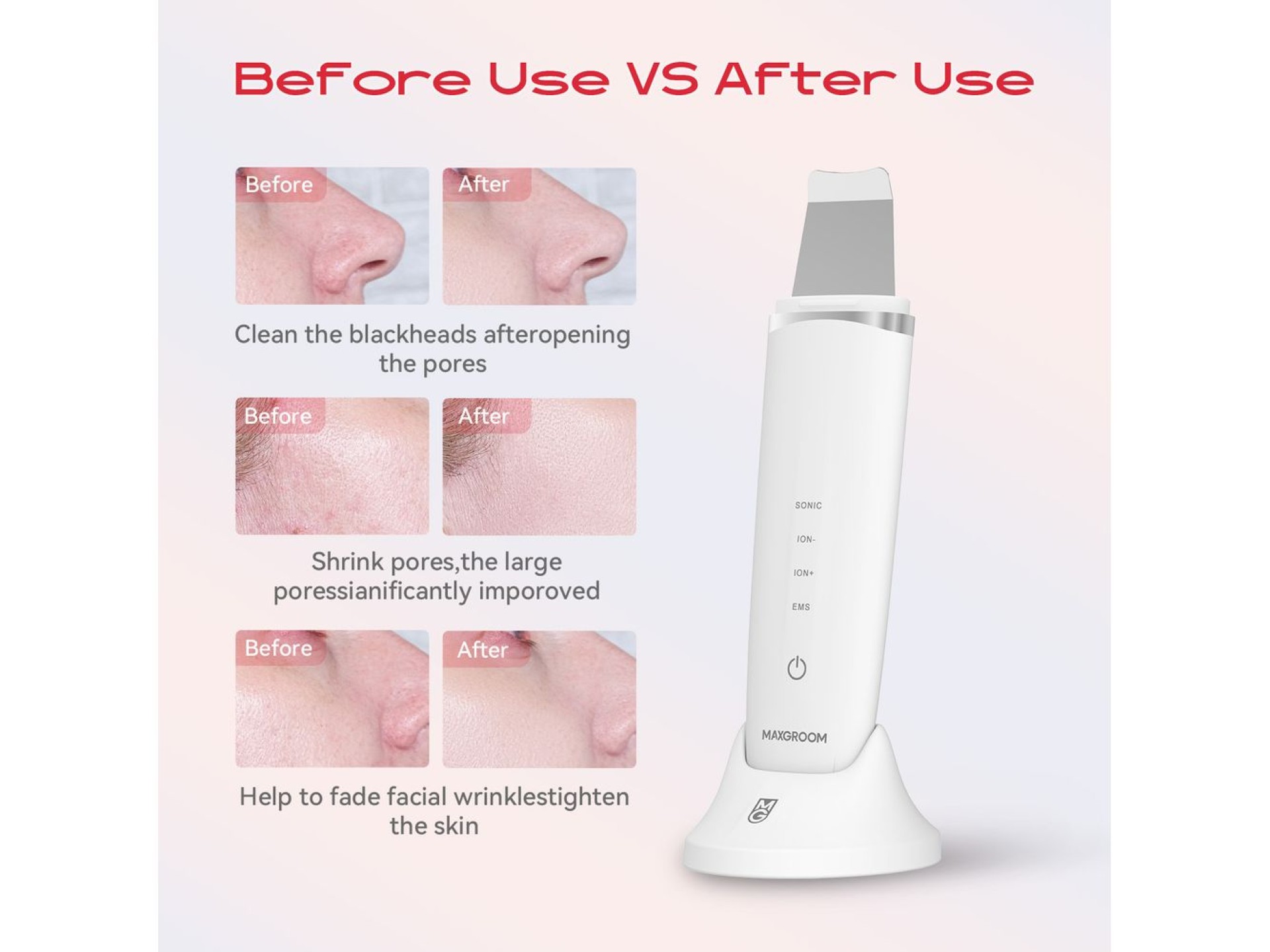 MAXGROOM M-169 ultrasonic cavitation peeling device with LED light therapy - white