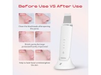 MAXGROOM M-169 ultrasonic cavitation peeling device with LED light therapy - white
