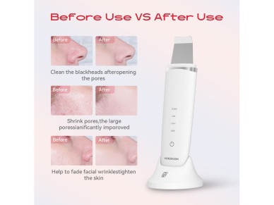 MAXGROOM M-169 ultrasonic cavitation peeling device with LED light therapy - white